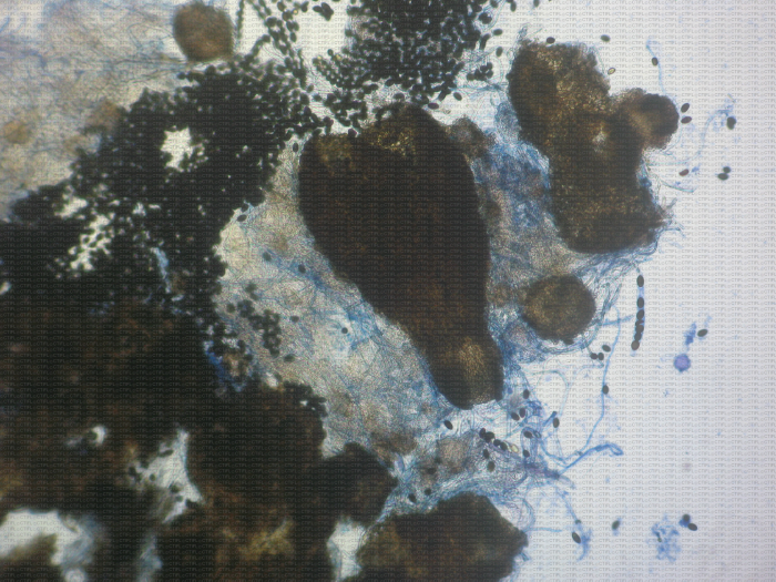 Périthèce de Sordaria (microscope) en culture